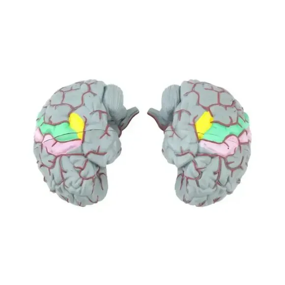 Life Size Human Brain Model - Medical Teaching (w/ 4 sections) EUC - Picture 5 of 10